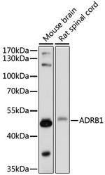 beta-1 Adrenergic Receptor Polyclonal Antibody
