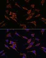RPS17 Antibody in Immunocytochemistry (ICC/IF)