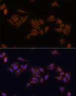 RPS17 Antibody in Immunocytochemistry (ICC/IF)