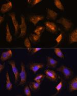 RPS17 Polyclonal Antibody