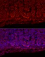 STAR Antibody in Immunocytochemistry (ICC/IF)