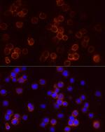 STAR Antibody in Immunocytochemistry (ICC/IF)