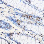 ZNF263 Polyclonal Antibody