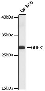 GLIPR1 Antibody in Western Blot (WB)
