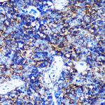 HEBP2 Antibody in Immunohistochemistry (Paraffin) (IHC (P))