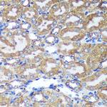 HEBP2 Antibody in Immunohistochemistry (Paraffin) (IHC (P))