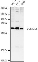 COMMD5 Antibody in Western Blot (WB)