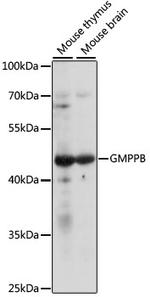 GMPPB Polyclonal Antibody