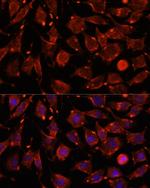 ITSN2 Antibody in Immunocytochemistry (ICC/IF)