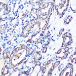MST4 Polyclonal Antibody