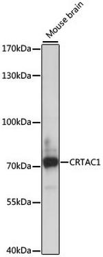 CRTAC1 Polyclonal Antibody