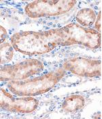 CHDH Antibody in Immunohistochemistry (Paraffin) (IHC (P))