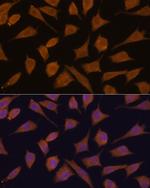 SEPTIN 3 Antibody in Immunocytochemistry (ICC/IF)