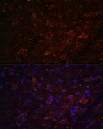FSTL5 Polyclonal Antibody