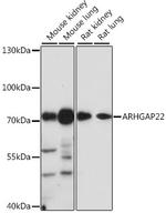 ARHGAP22 Polyclonal Antibody