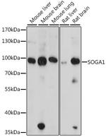 SOGA1 Polyclonal Antibody