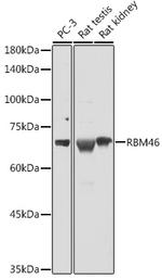 RBM46 Polyclonal Antibody