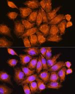 CCDC11 Polyclonal Antibody
