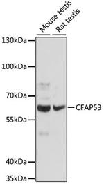 CCDC11 Antibody in Western Blot (WB)