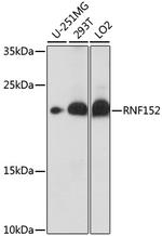 RNF152 Polyclonal Antibody