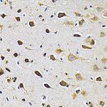 GRK2 Antibody in Immunohistochemistry (Paraffin) (IHC (P))