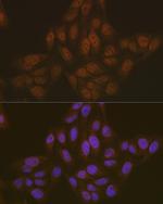 PYCARD Antibody in Immunocytochemistry (ICC/IF)