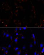 RPL26 Antibody in Immunocytochemistry (ICC/IF)