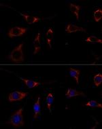 RPL26 Antibody in Immunocytochemistry (ICC/IF)