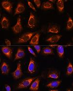 RPL26 Antibody in Immunocytochemistry (ICC/IF)