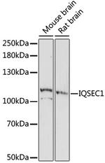 IQSEC1 Polyclonal Antibody