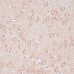 ARL4D Antibody in Immunohistochemistry (Paraffin) (IHC (P))