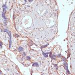 ARL4D Polyclonal Antibody