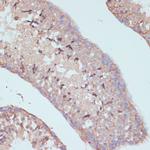 ARL4D Antibody in Immunohistochemistry (Paraffin) (IHC (P))