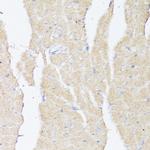 BMPR2 Antibody in Immunohistochemistry (Paraffin) (IHC (P))