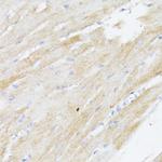 BMPR2 Antibody in Immunohistochemistry (Paraffin) (IHC (P))