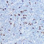 S100A8 Polyclonal Antibody