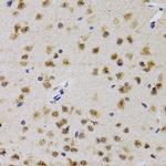 CDK7 Antibody in Immunohistochemistry (Paraffin) (IHC (P))