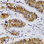 CDK7 Antibody in Immunohistochemistry (Paraffin) (IHC (P))