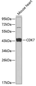 CDK7 Antibody in Western Blot (WB)