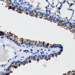 Uteroglobin Polyclonal Antibody