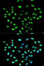 hnRNP K Polyclonal Antibody