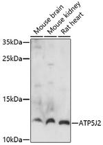 ATP5J2 Polyclonal Antibody