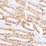 KEAP1 Antibody in Immunohistochemistry (Paraffin) (IHC (P))