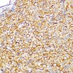 KEAP1 Antibody in Immunohistochemistry (Paraffin) (IHC (P))
