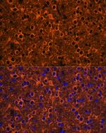 Beta III Tubulin Polyclonal Antibody