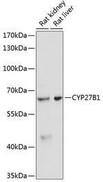 CYP27B1 Polyclonal Antibody