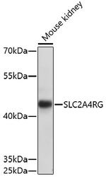 SLC2A4RG Polyclonal Antibody