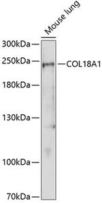Endostatin Polyclonal Antibody