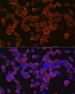 CHI3L1 Polyclonal Antibody