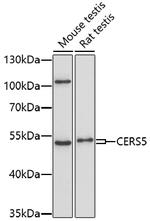 Lass5 Polyclonal Antibody